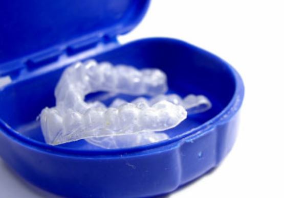 Photo of upper and lower teeth whitening trays in a blue case; for information on free teeth whitening from the office Plano dentist Dr. Miranda Lacy.