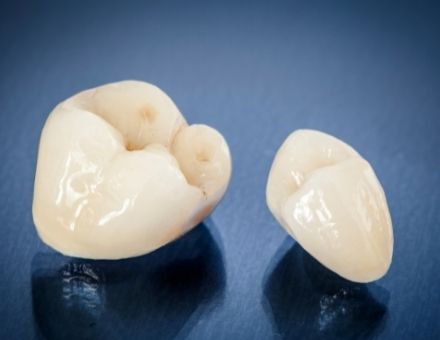 Two ceramic crowns
