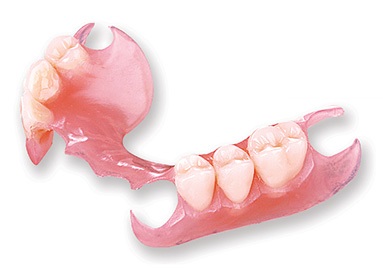 Valplast Partial Denture